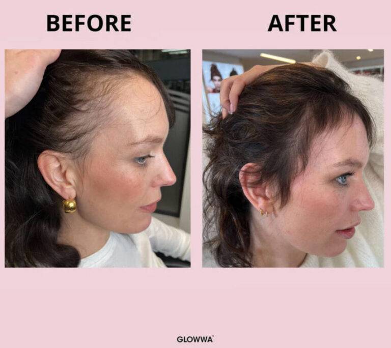 GLOWWA MENO hair and wellbeing supplement results